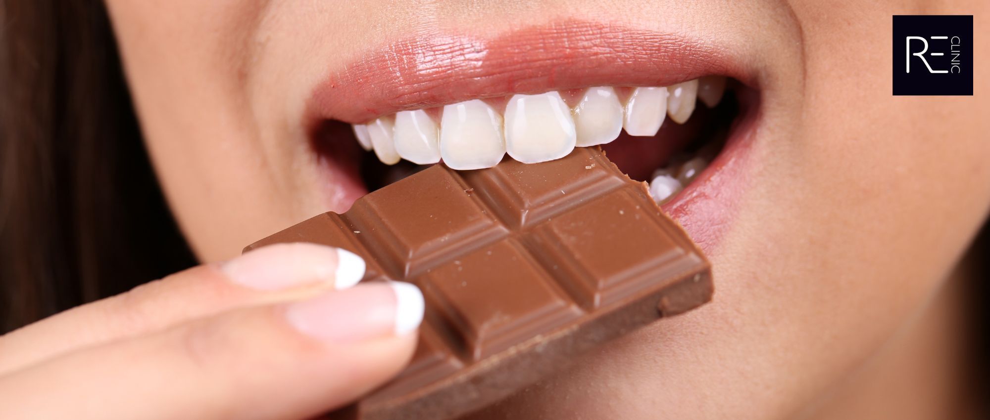 Chocolate binge causes wrinkles